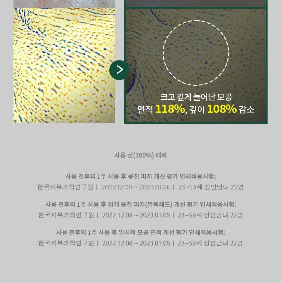 [개기름/지성] 닥터지 레드 블레미쉬 포 맨 올인원 오일컷 로션 150ml 3종 (단품/증정 기획) 상세페이지 12